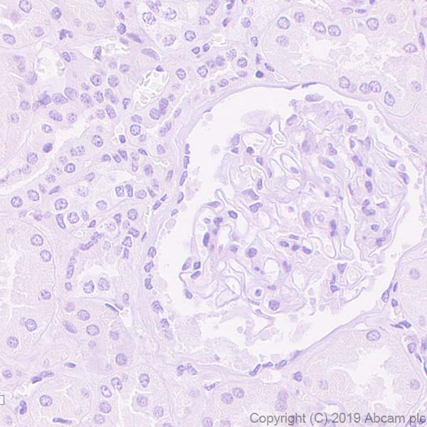 Immunohistochemistry (Formalin/PFA-fixed paraffin-embedded sections) - Anti-PMP22 antibody [EPR23112-110] (ab270400), expandable thumbnail