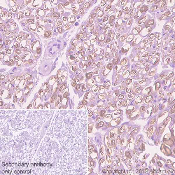 Immunohistochemistry (Formalin/PFA-fixed paraffin-embedded sections) - Anti-PMP22 antibody [EPR23112-110] - BSA and Azide free (AB270407)