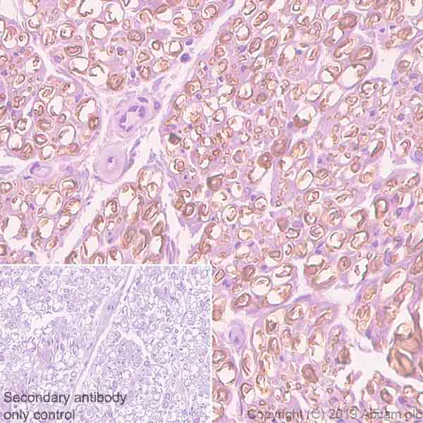 Immunohistochemistry (Formalin/PFA-fixed paraffin-embedded sections) - Anti-PMP22 antibody [EPR23112-110] - BSA and Azide free (AB270407)