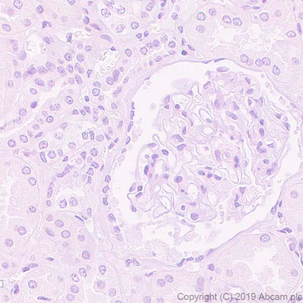 Immunohistochemistry (Formalin/PFA-fixed paraffin-embedded sections) - Anti-PMP22 antibody [EPR23112-110] - BSA and Azide free (AB270407)