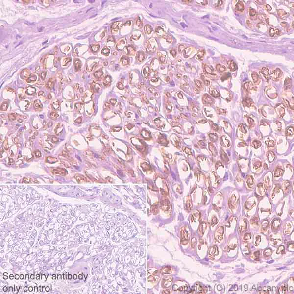 Immunohistochemistry (Formalin/PFA-fixed paraffin-embedded sections) - Anti-PMP22 antibody [EPR23113-31] (AB270399)