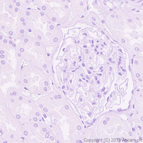 Immunohistochemistry (Formalin/PFA-fixed paraffin-embedded sections) - Anti-PMP22 antibody [EPR23113-31] (AB270399)