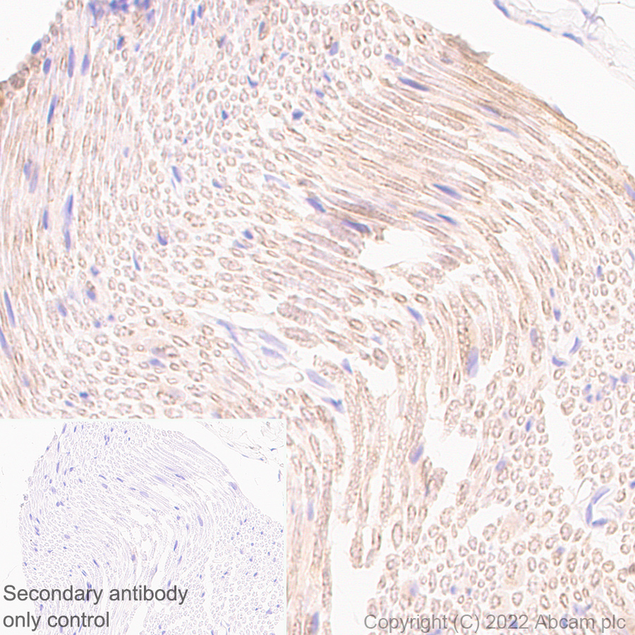 Immunohistochemistry (Formalin/PFA-fixed paraffin-embedded sections) - Anti-PMP22 antibody [EPR26310-118-5] - BSA and Azide free (AB303559), expandable thumbnail