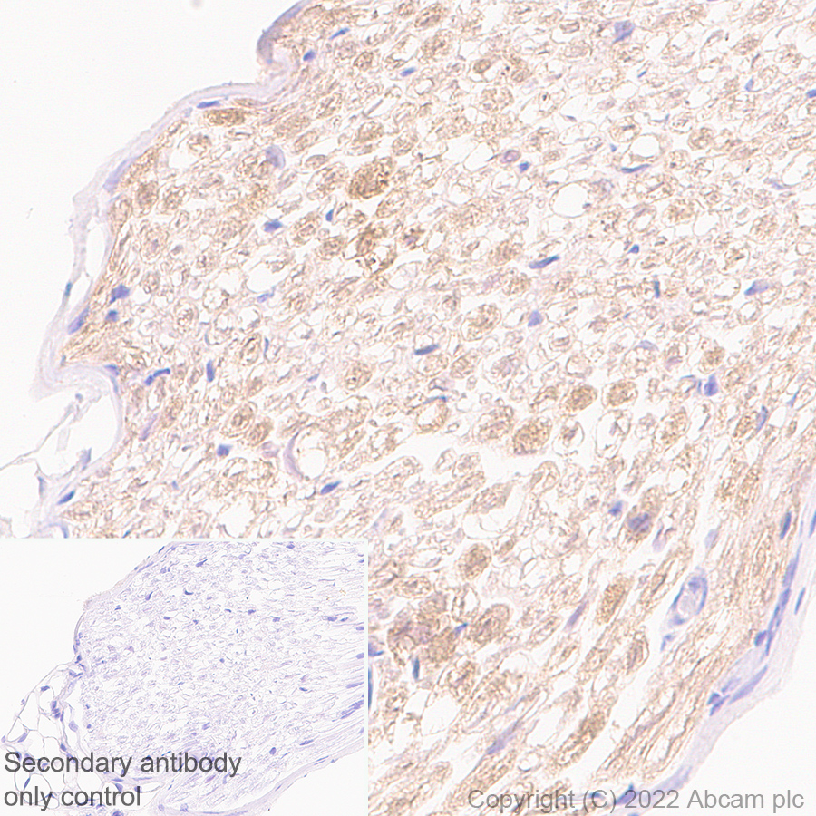 Immunohistochemistry (Formalin/PFA-fixed paraffin-embedded sections) - Anti-PMP22 antibody [EPR26310-118-5] - BSA and Azide free (AB303559), expandable thumbnail