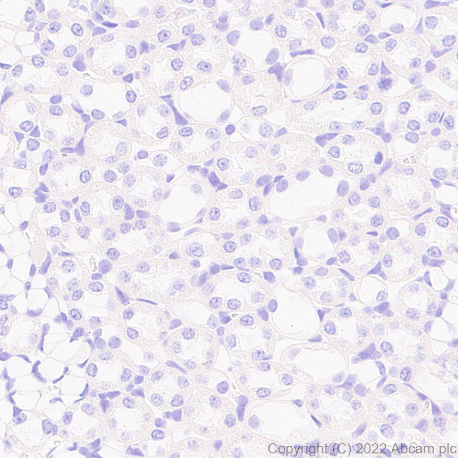 Immunohistochemistry (Formalin/PFA-fixed paraffin-embedded sections) - Anti-PMP22 antibody [EPR26310-118-5] - BSA and Azide free (AB303559), expandable thumbnail