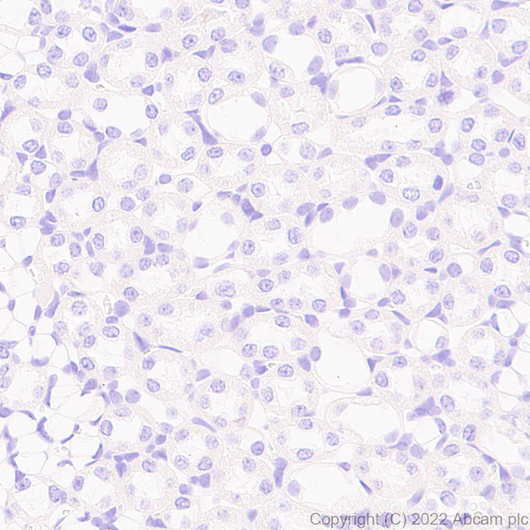 Immunohistochemistry (Formalin/PFA-fixed paraffin-embedded sections) - Anti-PMP22 antibody [EPR26310-118-5] - BSA and Azide free (AB303559)