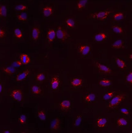 Immunocytochemistry/ Immunofluorescence - Anti-PMP70 antibody (AB3421)