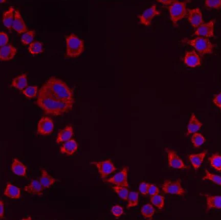Immunocytochemistry/ Immunofluorescence - Anti-PMP70 antibody (AB3421)
