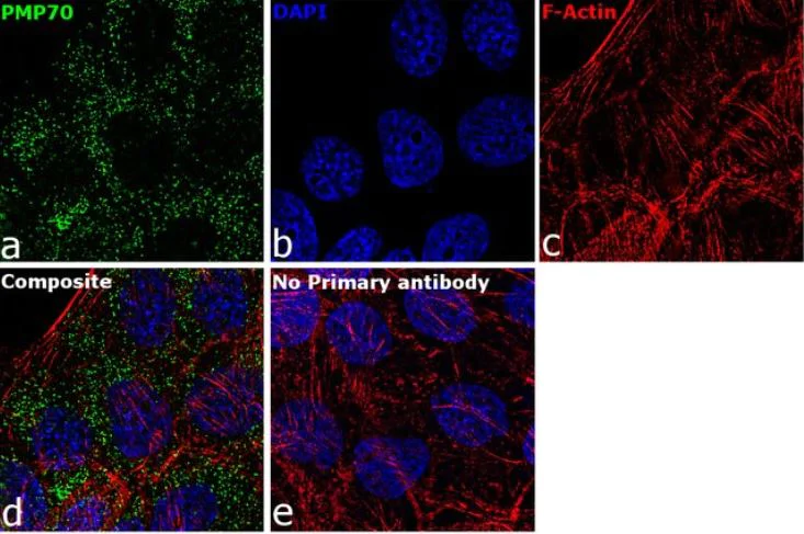 Immunocytochemistry/ Immunofluorescence - Anti-PMP70 antibody (AB3421)
