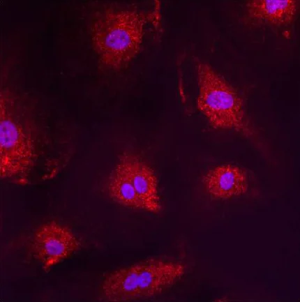 Immunocytochemistry/ Immunofluorescence - Anti-PMP70 antibody (AB3421)