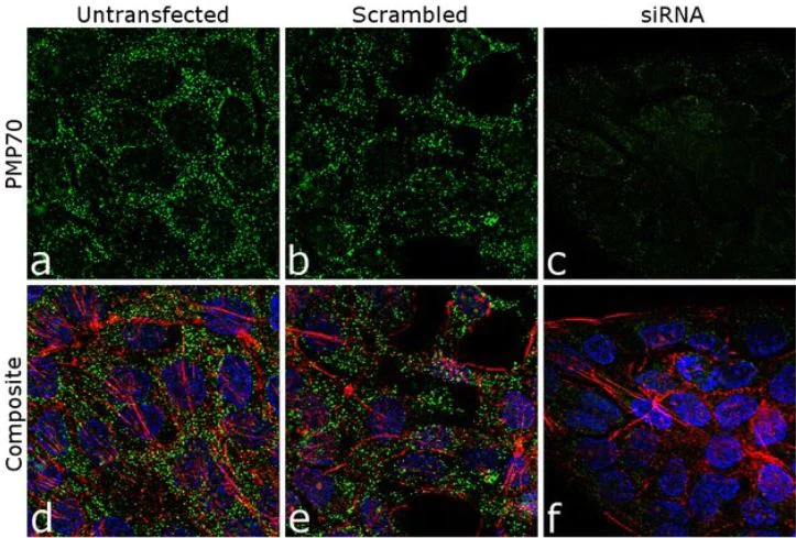Immunocytochemistry/ Immunofluorescence - Anti-PMP70 antibody (AB3421)