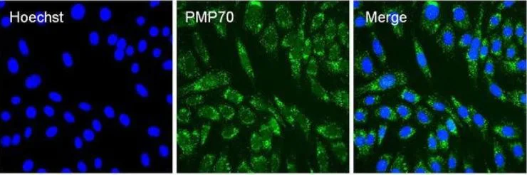 Immunocytochemistry/ Immunofluorescence - Anti-PMP70 antibody (AB3421)