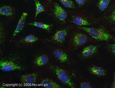 Immunocytochemistry/ Immunofluorescence - Anti-PMP70 antibody (AB3421)