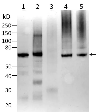 Western blot - Anti-PMP70 antibody (AB3421)