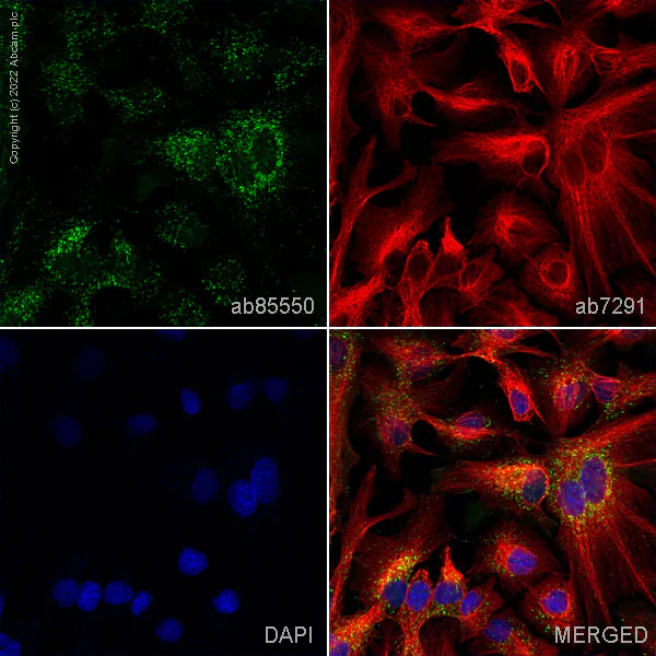Immunocytochemistry/ Immunofluorescence - Anti-PMP70 antibody (AB85550)
