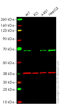 Western blot - Anti-PMP70 antibody (AB85550)