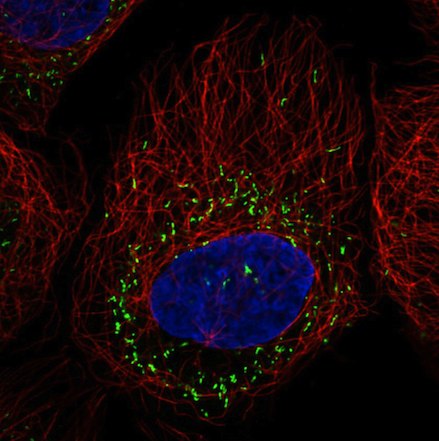 Immunocytochemistry/ Immunofluorescence - Anti-PMP70 antibody [CL2524] (AB211533), expandable thumbnail