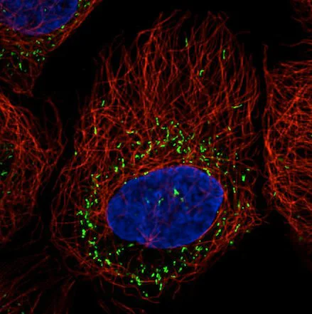 Immunocytochemistry/ Immunofluorescence - Anti-PMP70 antibody [CL2524] (AB211533)