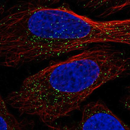 Immunocytochemistry/ Immunofluorescence - Anti-PMP70 antibody [CL2524] (AB211533), expandable thumbnail