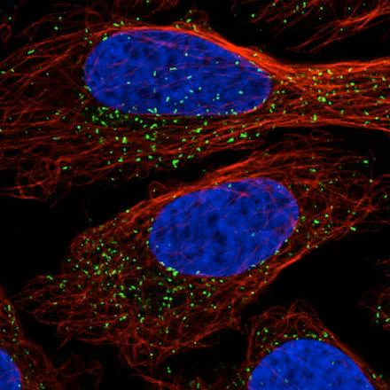 Immunocytochemistry/ Immunofluorescence - Anti-PMP70 antibody [CL2524] (AB211533)