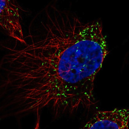 Immunocytochemistry/ Immunofluorescence - Anti-PMP70 antibody [CL2524] (AB211533), expandable thumbnail