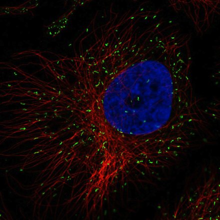 Immunocytochemistry/ Immunofluorescence - Anti-PMP70 antibody [CL2524] (AB211533), expandable thumbnail