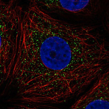 Immunocytochemistry/ Immunofluorescence - Anti-PMP70 antibody [CL2524] (AB211533), expandable thumbnail