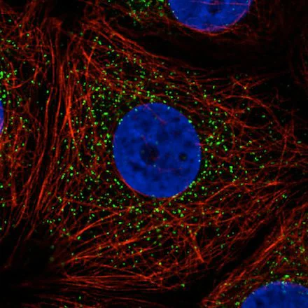 Immunocytochemistry/ Immunofluorescence - Anti-PMP70 antibody [CL2524] (AB211533)
