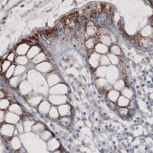 Immunohistochemistry (Formalin/PFA-fixed paraffin-embedded sections) - Anti-PMP70 antibody [CL2524] (ab211533), expandable thumbnail