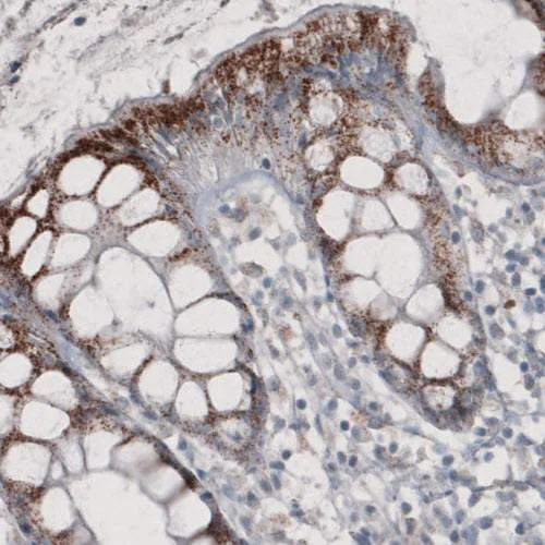 Immunohistochemistry (Formalin/PFA-fixed paraffin-embedded sections) - Anti-PMP70 antibody [CL2524] (AB211533)