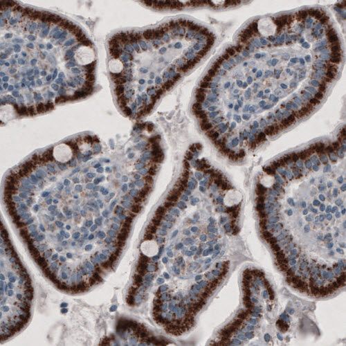 Immunohistochemistry (Formalin/PFA-fixed paraffin-embedded sections) - Anti-PMP70 antibody [CL2524] (ab211533), expandable thumbnail