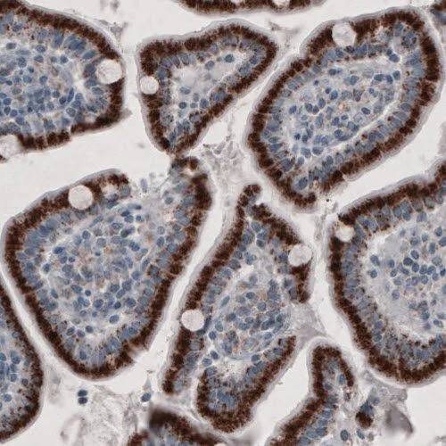 Immunohistochemistry (Formalin/PFA-fixed paraffin-embedded sections) - Anti-PMP70 antibody [CL2524] (AB211533)