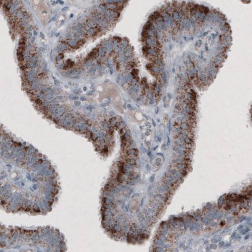 Immunohistochemistry (Formalin/PFA-fixed paraffin-embedded sections) - Anti-PMP70 antibody [CL2524] (ab211533), expandable thumbnail