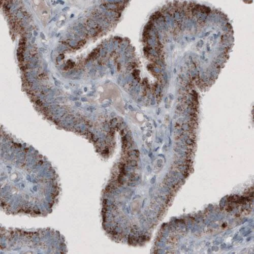 Immunohistochemistry (Formalin/PFA-fixed paraffin-embedded sections) - Anti-PMP70 antibody [CL2524] (AB211533)