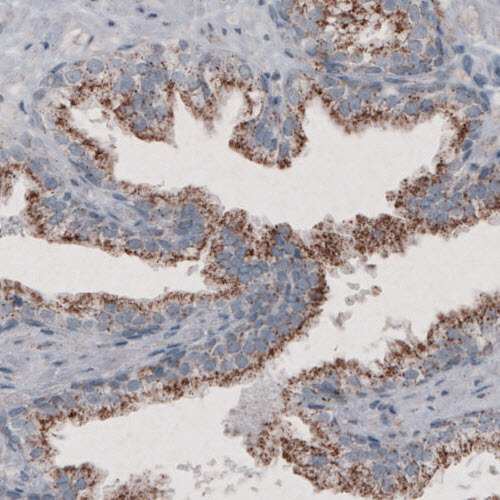 Immunohistochemistry (Formalin/PFA-fixed paraffin-embedded sections) - Anti-PMP70 antibody [CL2524] (ab211533), expandable thumbnail