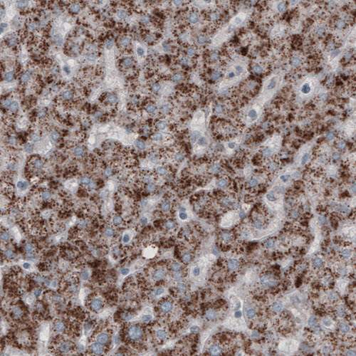 Immunohistochemistry (Formalin/PFA-fixed paraffin-embedded sections) - Anti-PMP70 antibody [CL2524] (ab211533), expandable thumbnail