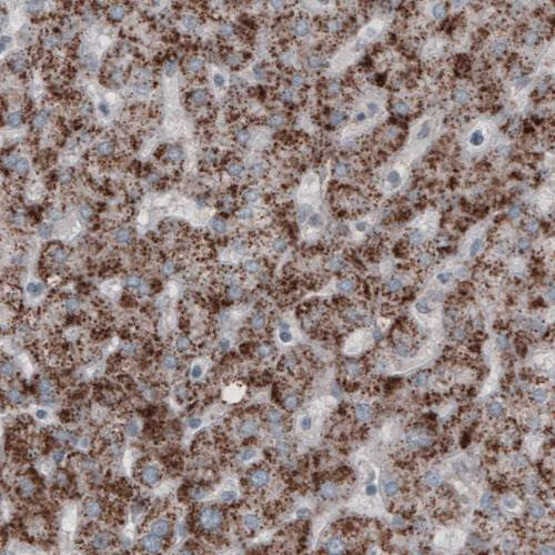 Immunohistochemistry (Formalin/PFA-fixed paraffin-embedded sections) - Anti-PMP70 antibody [CL2524] (AB211533)