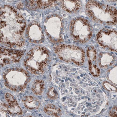 Immunohistochemistry (Formalin/PFA-fixed paraffin-embedded sections) - Anti-PMP70 antibody [CL2524] (ab211533), expandable thumbnail