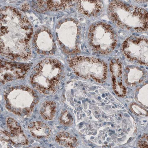 Immunohistochemistry (Formalin/PFA-fixed paraffin-embedded sections) - Anti-PMP70 antibody [CL2524] (AB211533)