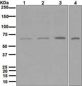 Western blot - Anti-PMP70 antibody [EPR5614] (AB109448)