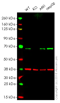 Western blot - Anti-PMP70 antibody [EPR5614] (AB109448)