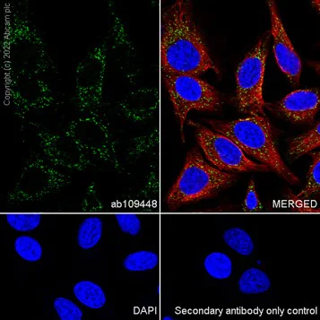 Immunocytochemistry/ Immunofluorescence - Anti-PMP70 antibody [EPR5614] - BSA and Azide free (AB247868)