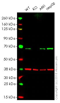 Western blot - Anti-PMP70 antibody [EPR5614] - BSA and Azide free (AB247868)