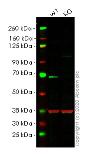 Western blot - Anti-PMP70 antibody [EPR5614] - BSA and Azide free (AB247868)