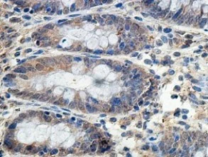 Immunohistochemistry (Formalin/PFA-fixed paraffin-embedded sections) - Anti-PMPCA/INPP5E antibody (AB140171)