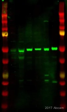 Western blot - Anti-PMPCA/INPP5E antibody (AB140171)
