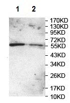 Western blot - Anti-PMPCA/INPP5E antibody (AB140171)