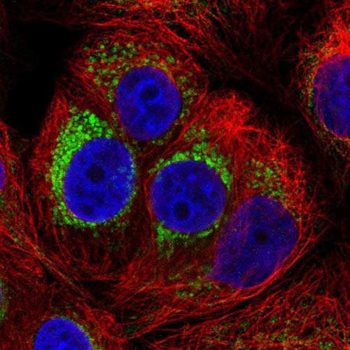 Immunocytochemistry/ Immunofluorescence - Anti-PMPCA/INPP5E antibody (AB221117)