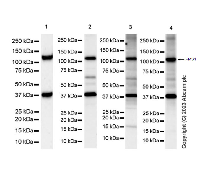Anti-PMS1 antibody [EPR27158-78] KO Tested (ab315798) | Abcam