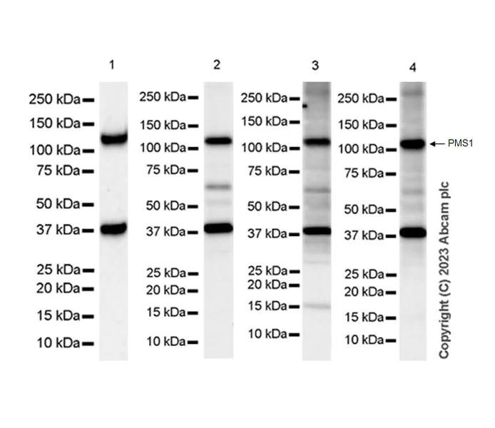 Western blot - Anti-PMS1 antibody [EPR27158-78] - BSA and Azide free (AB315799)